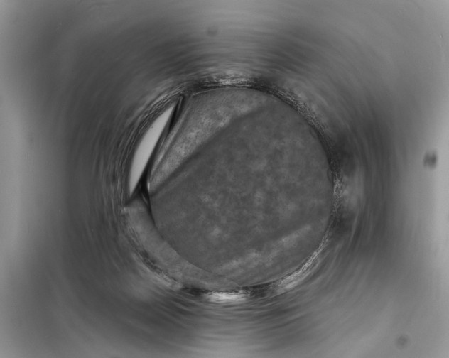 X0000098200170200805081119