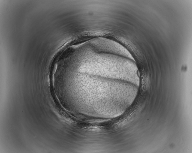 X0000098200254200805081118