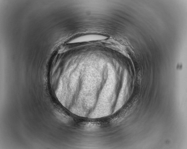 X0000098200303200805081117