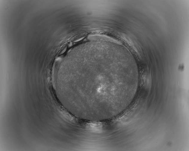 X0000098200317200805081117