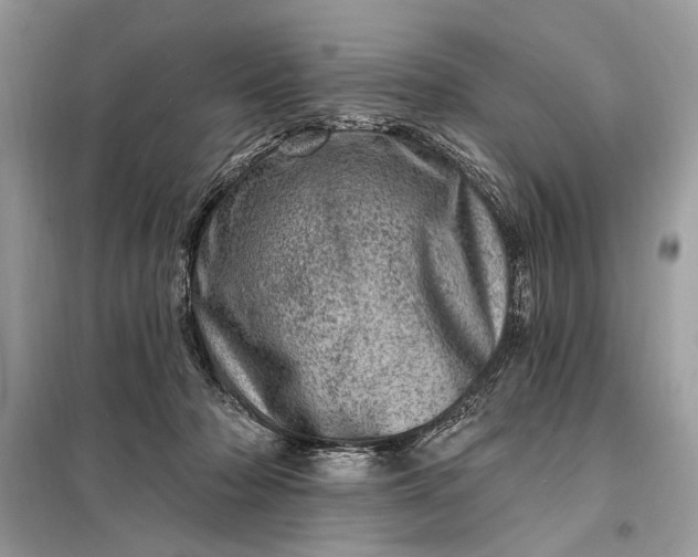 X0000098200318200805081117