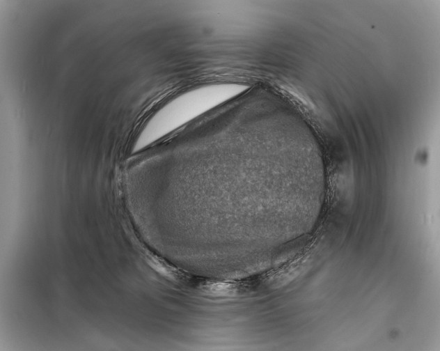 X0000098200325200805081117