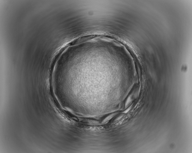 X0000098200345200805081116