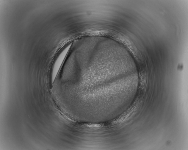 X0000098200357200805081117