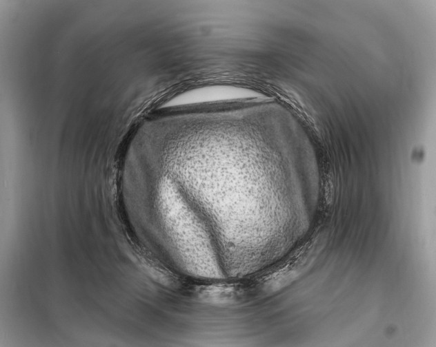X0000098200366200805081117