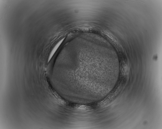 X0000098200467200805081115