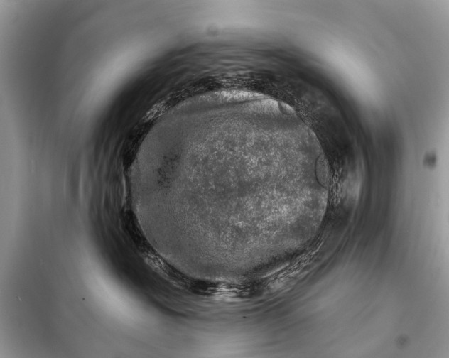 X0000098200574200805081114