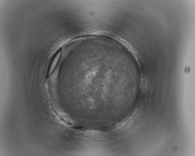 X0000098200577200805081113