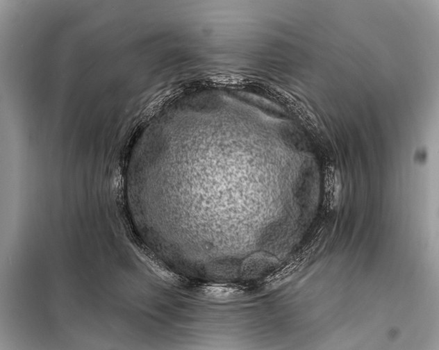 X0000098200614200805081113
