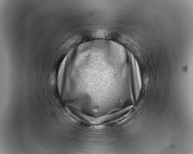 X0000098200665200805081113