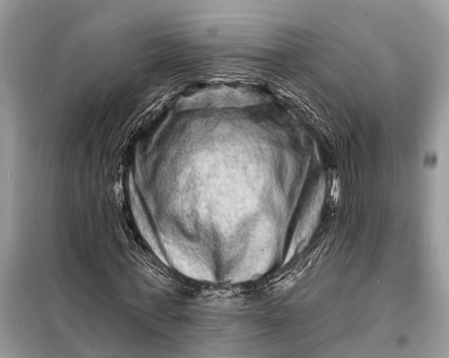 X0000098200771200805081110