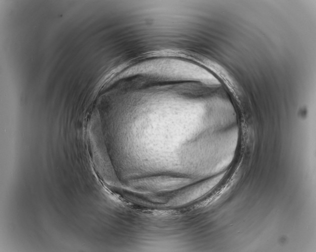 X0000098200857200805081110