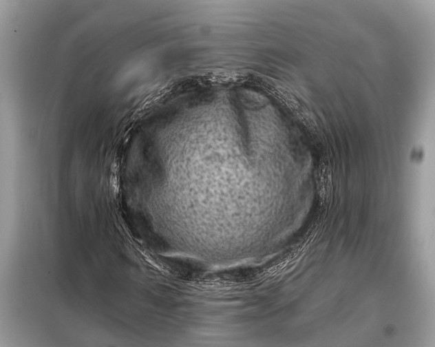 X0000098200962200805081107