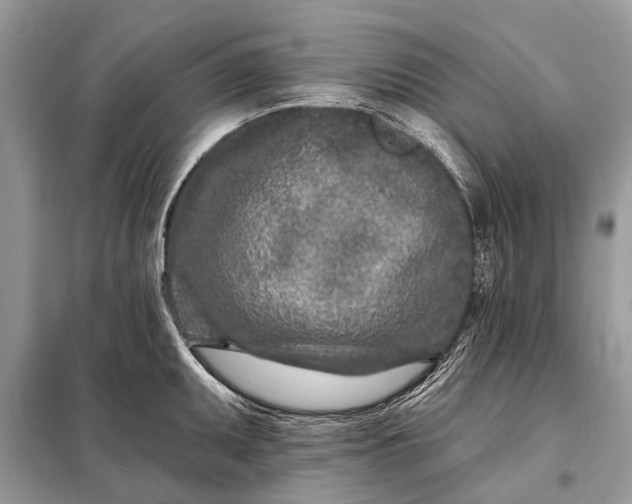 X0000098201095200805081105