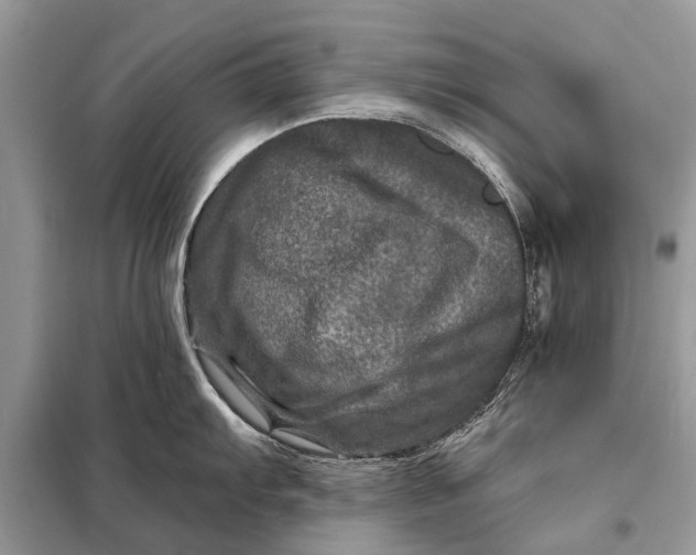 X0000098201103200805081105