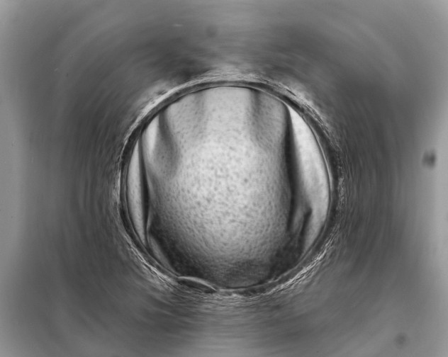 X0000098201220200805081103