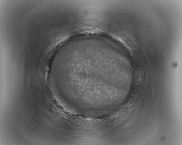 X0000098201399200805081100