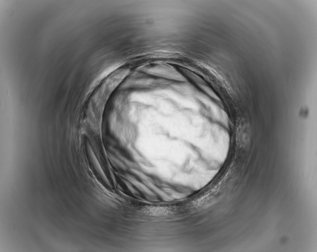 X0000098201402200805081100