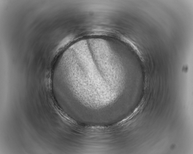 X0000098201403200805081100