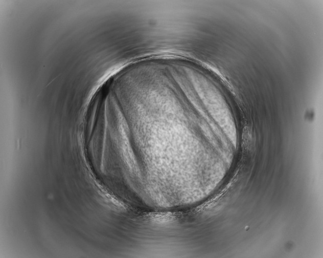 X0000098201410200805081100