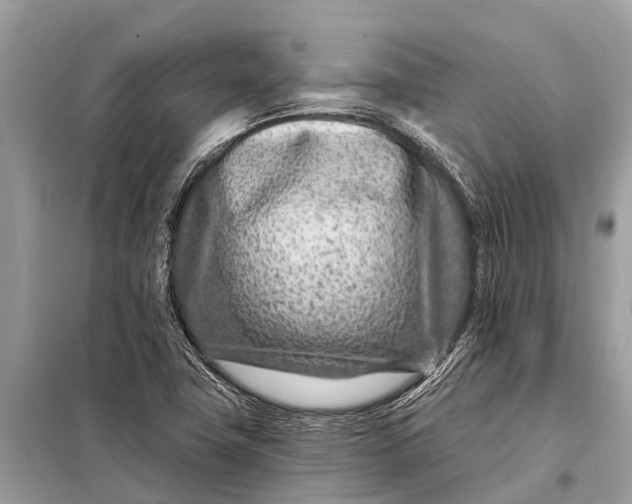 X0000098201411200805081100