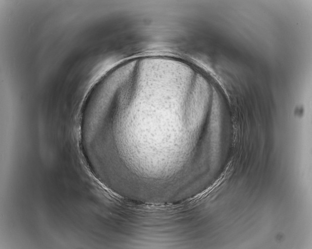 X0000098201415200805081100