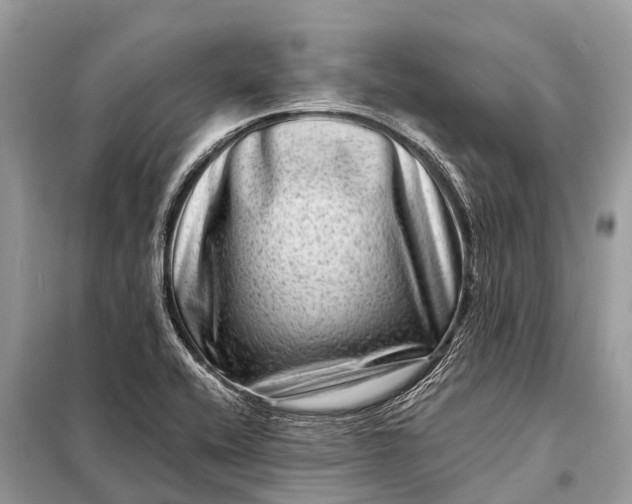 X0000098201416200805081100