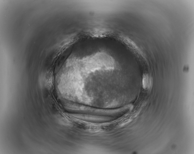 X0000098201444200805081100