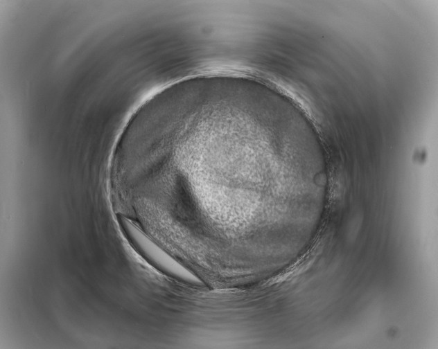 X0000098201471200805081100