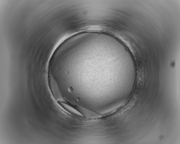 X0000098201475200805081100