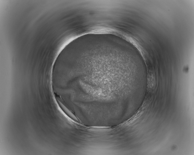 X0000098201487200805081059