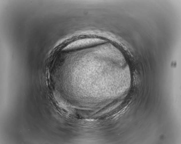 X0000098201494200805081059