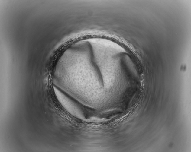 X0000098201495200805081059