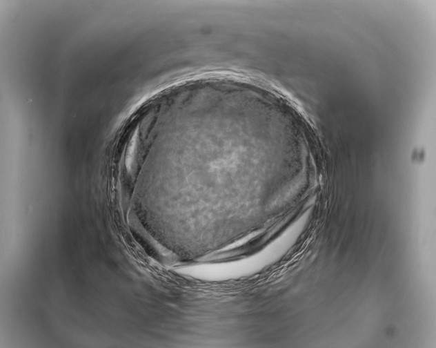 X0000098201496200805081059