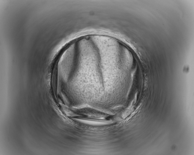 X0000098201503200805081059