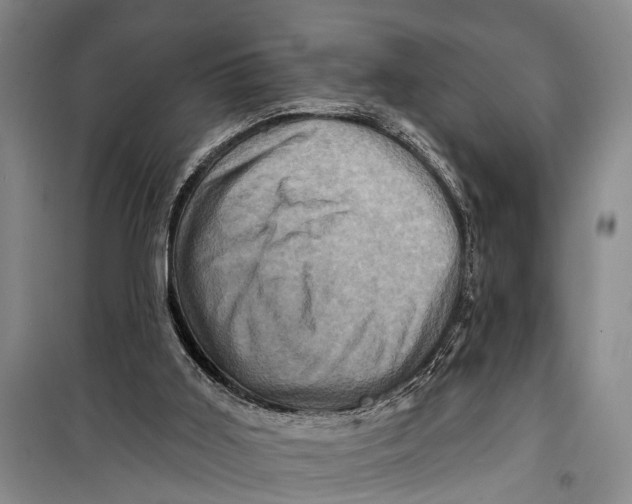 X0000098200011200805151239