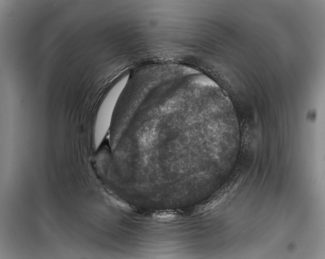 X0000098200076200805151238