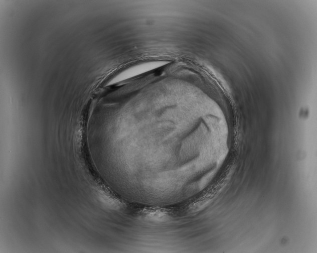 X0000098200113200805151238