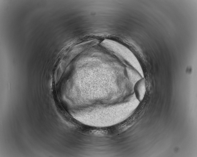 X0000098200115200805151238