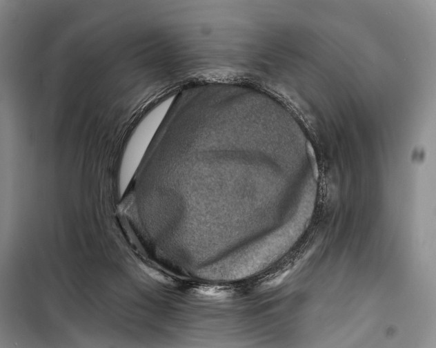 X0000098200117200805151238