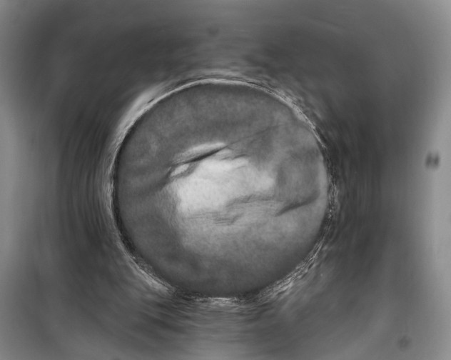 X0000098200151200805151237