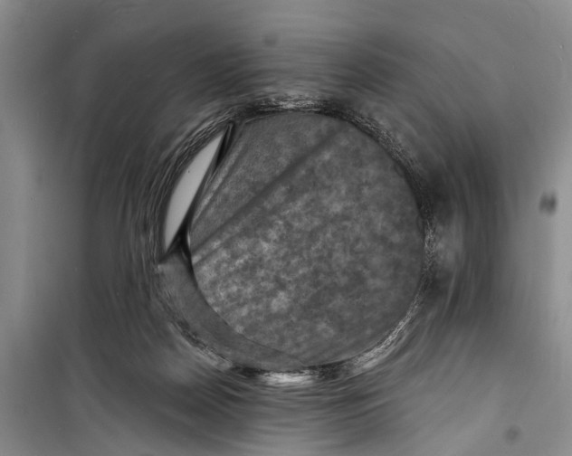X0000098200170200805151237
