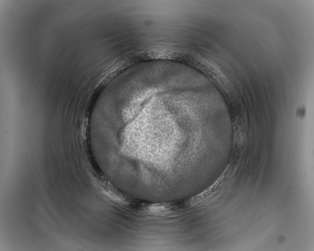X0000098200171200805151237
