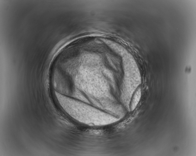 X0000098200247200805151235