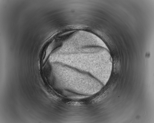 X0000098200254200805151235