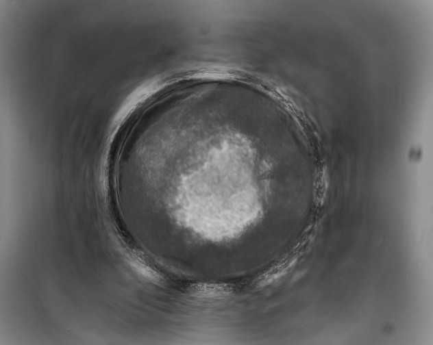 X0000098200296200805151235