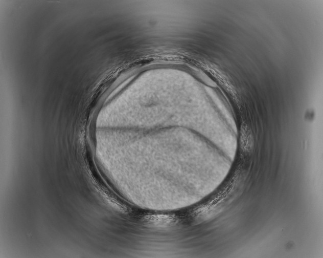 X0000098200449200805151232
