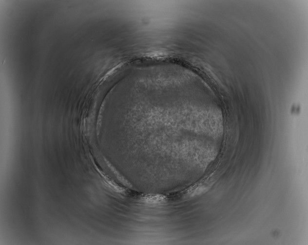X0000098200576200805151231