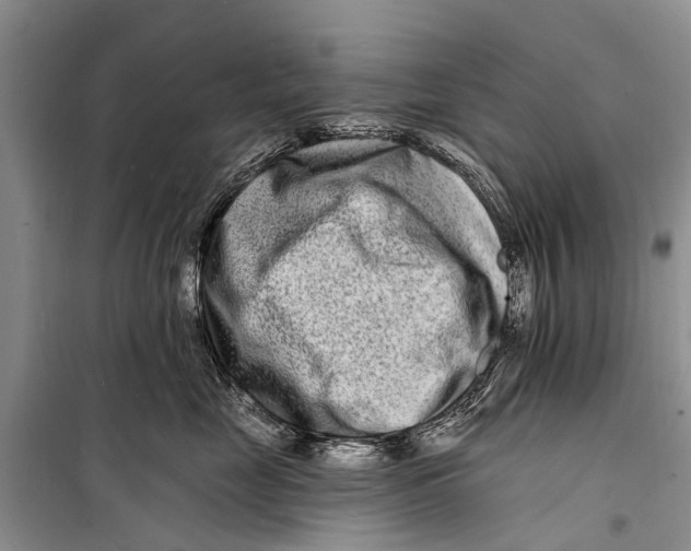X0000098200669200805151230