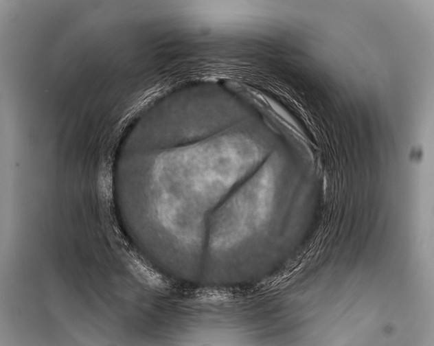 X0000098200729200805151228